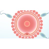 IVF University logo - Similar company to Value Creation Strategies Holdings