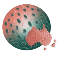 Australasian Metastasis Research Society (Ozmrs)