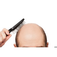 Hair Transplant in Delhi logo - Similar company to Panacea Global