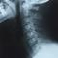 Anacker Clinic Of Chiropractic
