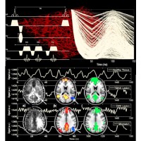 Neuroimaging Grenoble Institut Neurosciences logo - Similar company to Neurodigitech, A Neuro-Based Cro Biotech