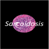 Sarcoid Research and Education Foundation logo - Similar company to Cdb Concept