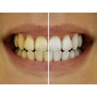 InOffice Teeth Whitening logo - Similar company to Arctic Whitening