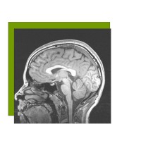 Mind Health PLLC logo - Similar company to Bluesprig - Formerly Tdlc