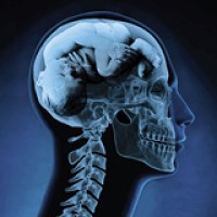 Brainchild Creative logo - Similar company to Brainchild