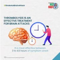 ACTIVATE_STROKE_THROMBOLYSIS logo - Similar company to Mijo Express