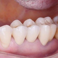 Alfred Dental Lab logo - Similar company to Hue Dental Lab
