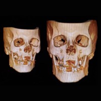Neurosurgery Le Freak