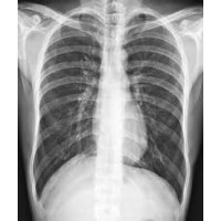 Digital Portable X - Ray logo - Similar company to Specialty Portable X-Ray, Inc.
