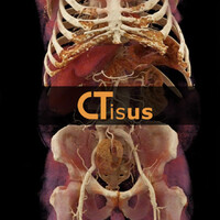 CTisus logo - Similar company to Everything Mri