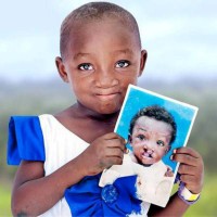 Operation Smile South Africa