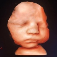 4D Moments Ultrasound LLC logo - Similar company to Ultrasound Technologists, Llc