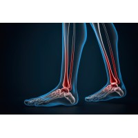 Foot and Ankle Center of New Jersey (FACNJ) logo - Similar company to Advanced Foot Care