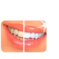 Davinci Laser Teeth Whitening logo - Similar company to Teeth Whitening Centers