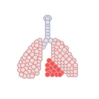 Lungtreater