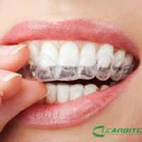 Clearbite Aligners logo - Similar company to V-Clear Aligners