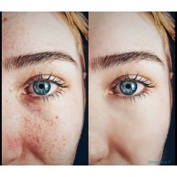 Buttercup17 Image Editing and Retouching logo - Similar company to Image Cut Out Store