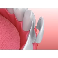 Dental Veneers Network logo - Similar company to Veneer