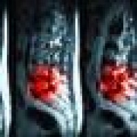 Apex Orthopedic Rehabilitation