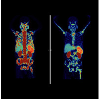 PSMA & Beyond Conference logo - Similar company to Molecular Diagnostics And Therapy
