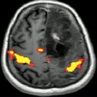 fMRI Course logo - Similar company to Brainscandiagnostics Inc. Fmri Neuropsych Testing For Cte, Mtbi, Concussions