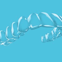 Spark Aligners UK, Ireland & Iceland logo - Similar company to Spark Alchemy