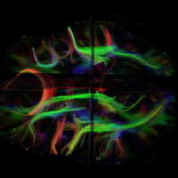 MIND Laboratory (Music, Imaging, and Neural Dynamics) logo - Similar company to Simplevoip