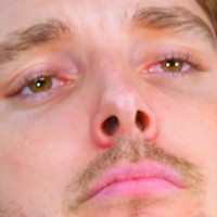 LazarBeam logo - Similar company to Vindooly