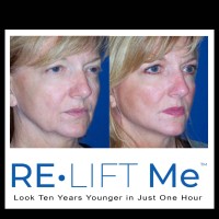 ReLiftMD logo - Similar company to Work Cultured Podcast