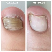 Foot Health Practitioner