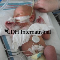 CDH International - the World's Oldest. Largest, and Leading Congenital Diaphragmatic Hernia Charity logo - Similar company to Policy Vets