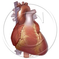 Gory Details Illustration