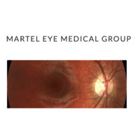 Martel Eye Medical Group