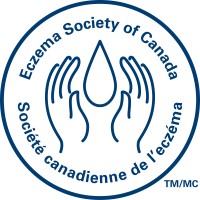 Eczema Society of Canada logo - Similar company to Bird Comm