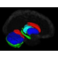 Brain Image Analysis, LLC