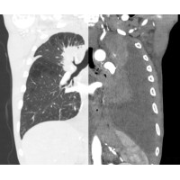 Adelaide Interventional Pulmonology and Pleural Group logo - Similar company to Marmona Marketing Llc