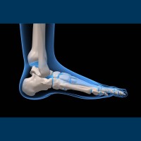 Pfa Pedorthic Footcare Association Canada