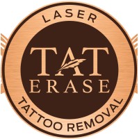Tat Erase logo - Similar company to Coast Aesthetics