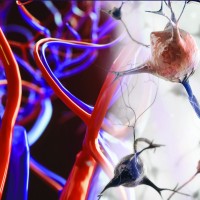 Neuroprotection logo - Similar company to Cometta