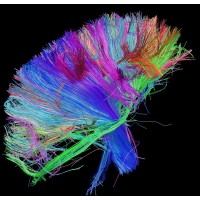 BLESTGROUP logo - Similar company to Wconnect Consulting