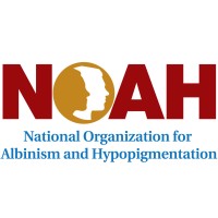 National Organization For Albinism And Hypopigmentation - Noah