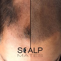ScalpMates | Scalp Micropigmetation in Birmingham UK logo - Similar company to Maroset