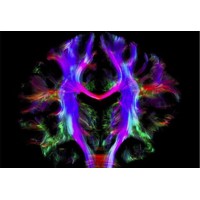 Service de radiologie diagnostique et interventionnelle de l'institut national d'oncologie de Rabat logo - Similar company to Aros Maroc - American Radiology Oncology Solutions