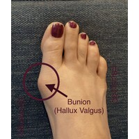 Bunion3D logo - Similar company to Gonbadekaboud