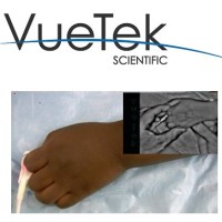 VueTek Scientific logo - Similar company to Zenith Vascular