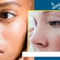 Balogna logo - Similar company to Skin Actives Scientific