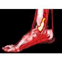 BOSS group - Biphasic Osteoarticular SPECT study group logo - Similar company to Atemen