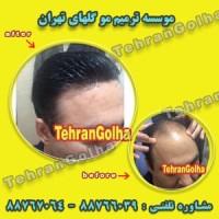 موسسه ترمیم مو گلهای تهران
