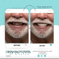 PrestoSmile® logo - Similar company to Gloud