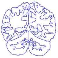Neuromorphometrics, Inc. logo - Similar company to Ahha Labs